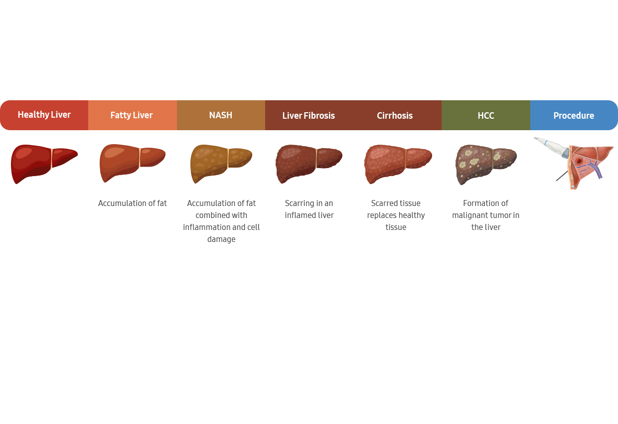 liver diagnosis Solutions