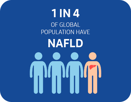 NAFLD statistics