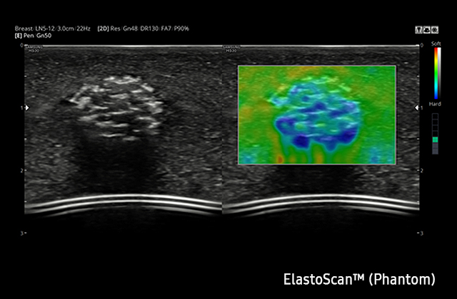 ElastoScan™ Sample