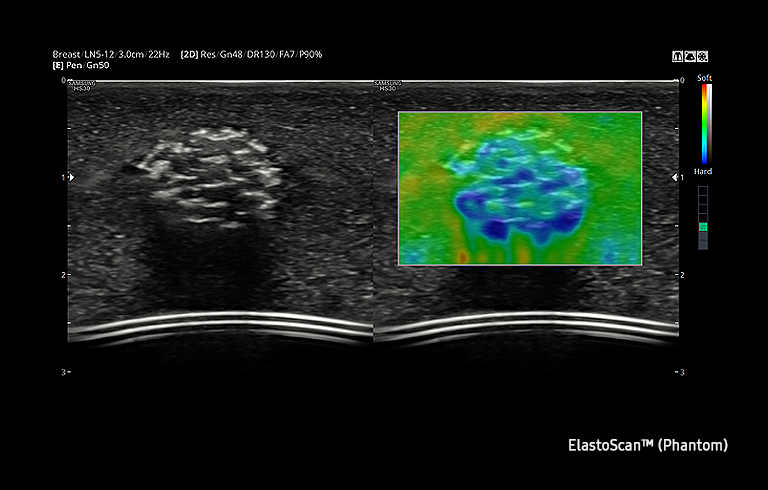 ElastoScan™ Sample