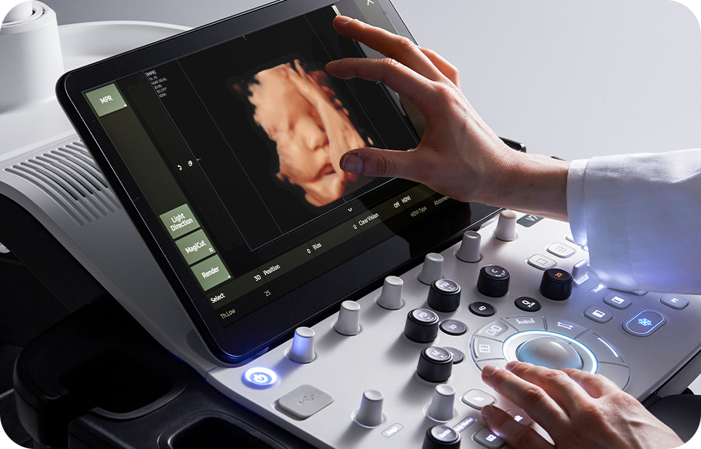 ob gyn ultrasound: V7
