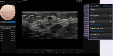 ultrasound for breast and care for breast : 5D NT™