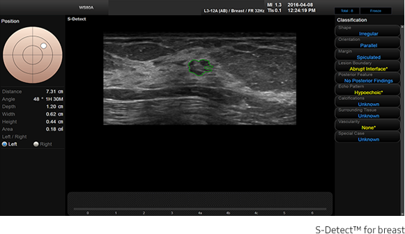 Cervix stiffness measurement with E-Cervix™