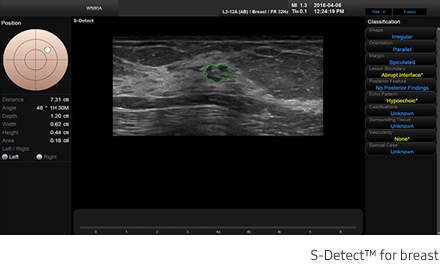 Cervix stiffness measurement with E-Cervix™