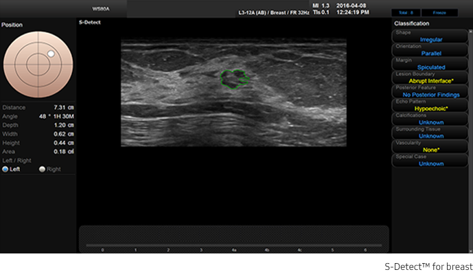 Cervix stiffness measurement with E-Cervix™