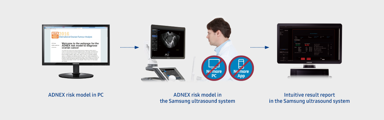 ADNEX risk model in PC/ADNEX risk model in the Samsung ultrasound system/Intuitive result report in the Samsung ultrasound system