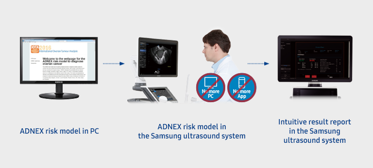 ADNEX risk model in PC/ADNEX risk model in the Samsung ultrasound system/Intuitive result report in the Samsung ultrasound system