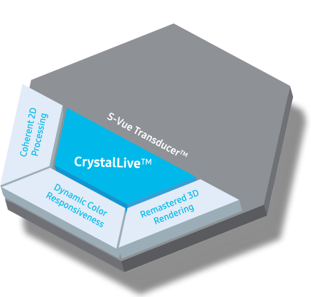 new ultrasound technology : Crystal Architecture™