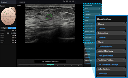 S-Detect™ for Breast