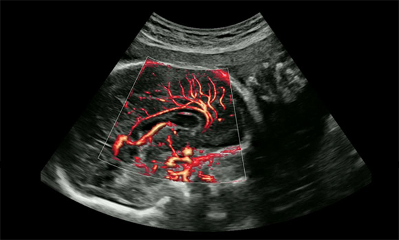 imaging solutions : MV-Flow™ with LumiFlow™