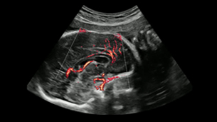 imaging solutions : MV-Flow™ with LumiFlow™