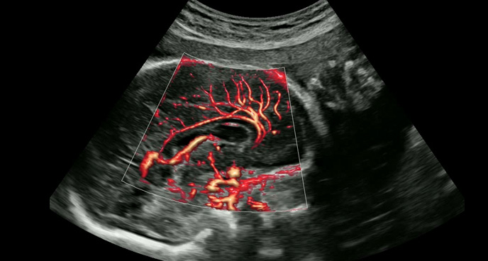 imaging solutions : MV-Flow™ with LumiFlow™