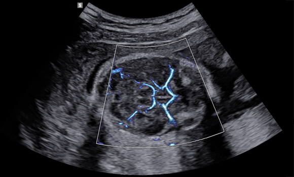 imaging solutions : MV-Flow™ with LumiFlow™