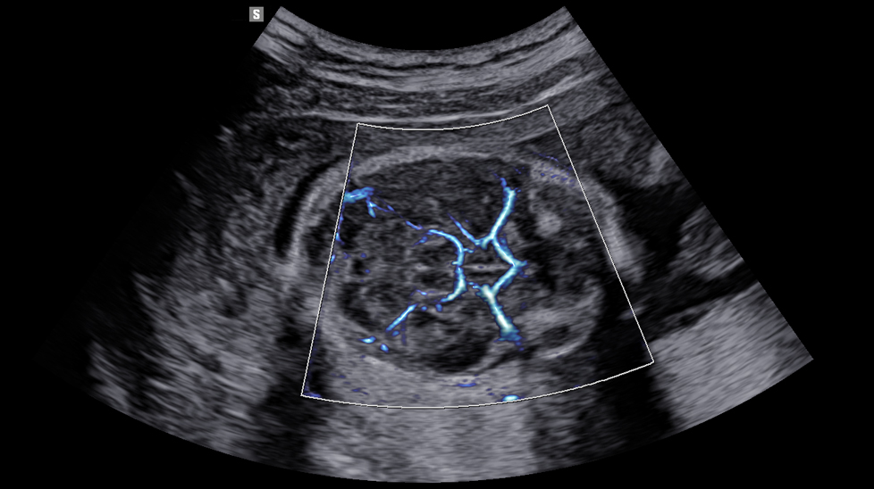 imaging solutions : MV-Flow™ with LumiFlow™