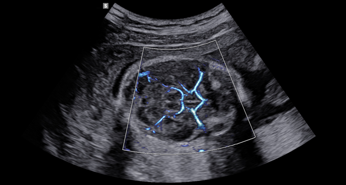 imaging solutions : MV-Flow™ with LumiFlow™