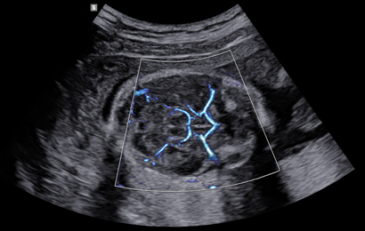 imaging solutions : MV-Flow™ with LumiFlow™