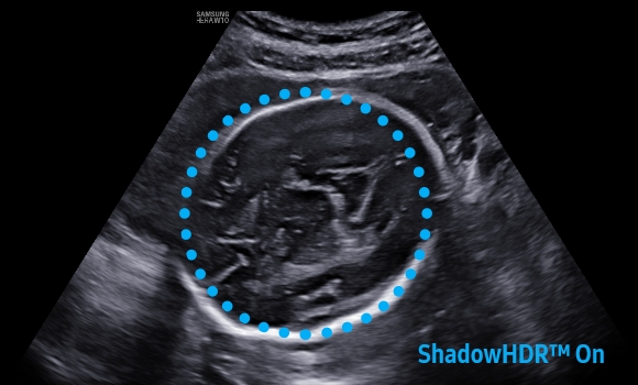 imaging solutions : ShadowHDR™