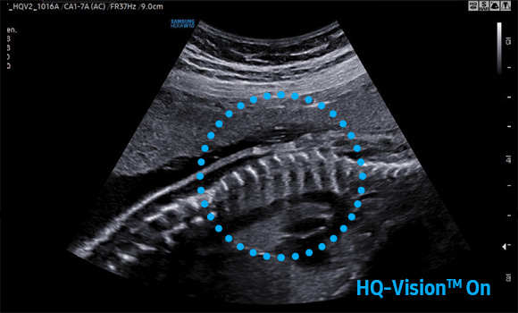 imaging solutions : HQ-Vision™