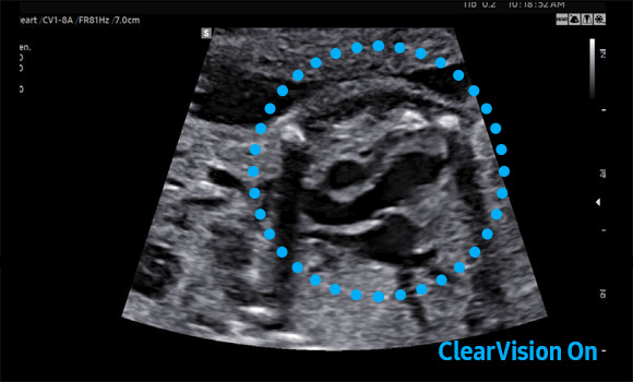 powerful imaging : ClearVision