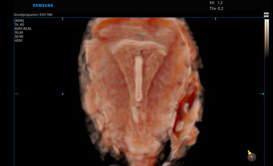 3d imaging : CrystalVue™ 