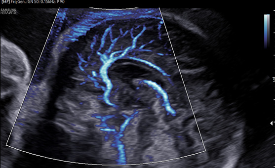 Color imaging : MV-Flow™