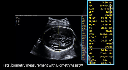 medical diagnostics : BiometryAssist™