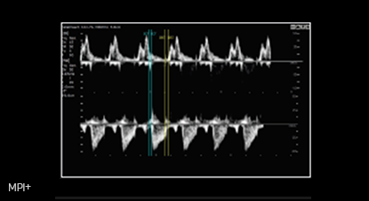 medical diagnostics : MPI+ 