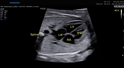 ob gyn ultrasound machine tech : ViewAssist™