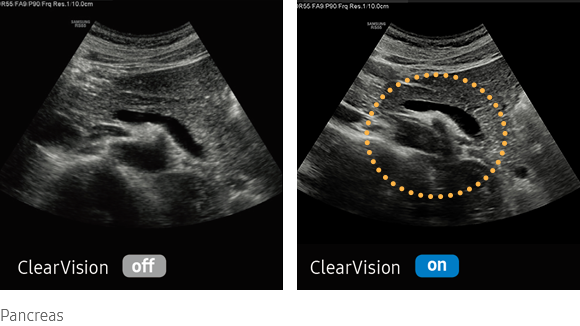 imaging solutions : ClearVison